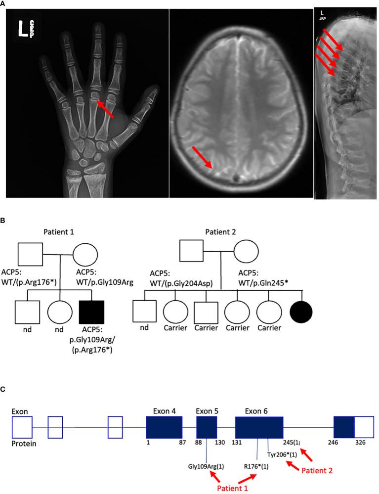 https://cdn.ncbi.nlm.nih.gov/pmc/blobs/563c/10859398/677a8e47ca7f/fimmu-14-1328005-g002.jpg