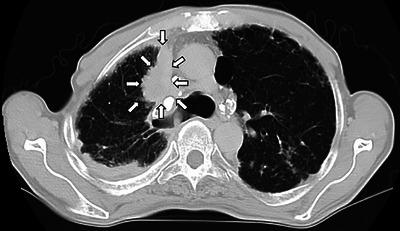 https://cdn.ncbi.nlm.nih.gov/pmc/blobs/563c/12038177/70474bc13d67/DEO2-6-e70127-g001.jpg