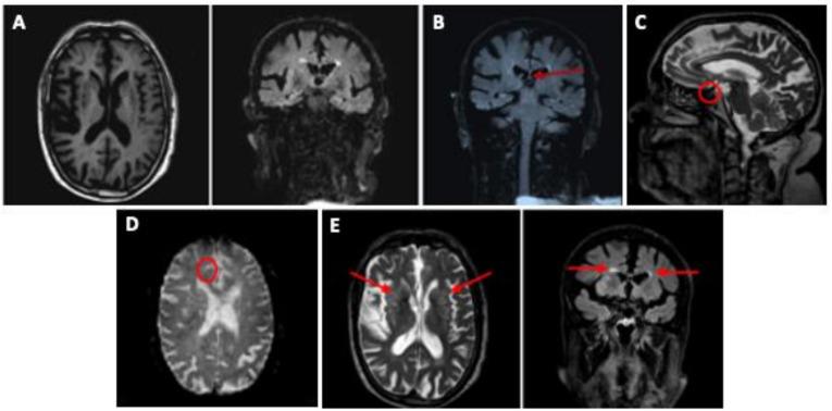 https://cdn.ncbi.nlm.nih.gov/pmc/blobs/5646/7908343/a25b9f4262cb/ijerph-18-00876-g001.jpg