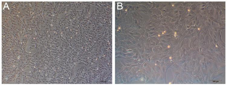 https://cdn.ncbi.nlm.nih.gov/pmc/blobs/564f/8540030/389c5b2d6c9e/membranes-11-00737-g012.jpg