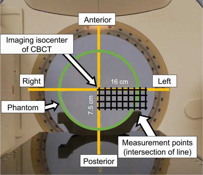 https://cdn.ncbi.nlm.nih.gov/pmc/blobs/5657/8200449/2d1a5b441bdf/ACM2-22-262-g003.jpg