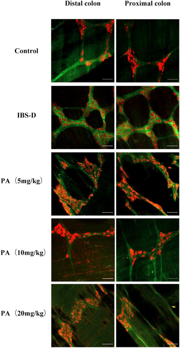 https://cdn.ncbi.nlm.nih.gov/pmc/blobs/565d/9703083/c979023ed85c/fphar-13-943119-g009.jpg
