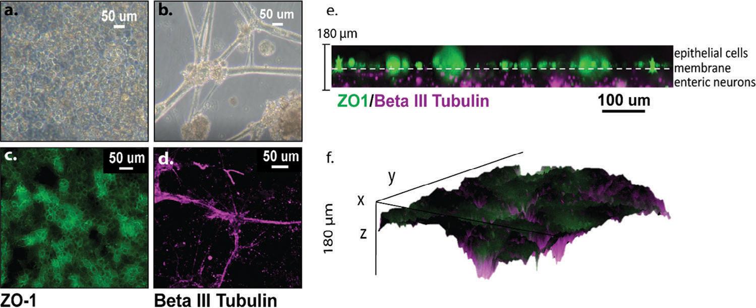 https://cdn.ncbi.nlm.nih.gov/pmc/blobs/565f/12380100/ee795ecdbe58/nihms-2086014-f0003.jpg