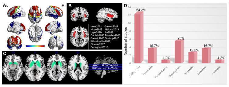 https://cdn.ncbi.nlm.nih.gov/pmc/blobs/5660/9599629/718b59f5b20e/brainsci-12-01334-g002.jpg