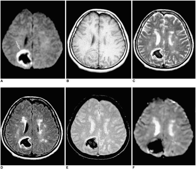 https://cdn.ncbi.nlm.nih.gov/pmc/blobs/5664/2718119/285b894e1776/kjr-2-183-g003.jpg