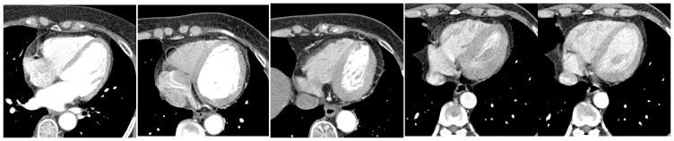 https://cdn.ncbi.nlm.nih.gov/pmc/blobs/566d/4148338/93c5468643b1/pone.0105815.g003.jpg