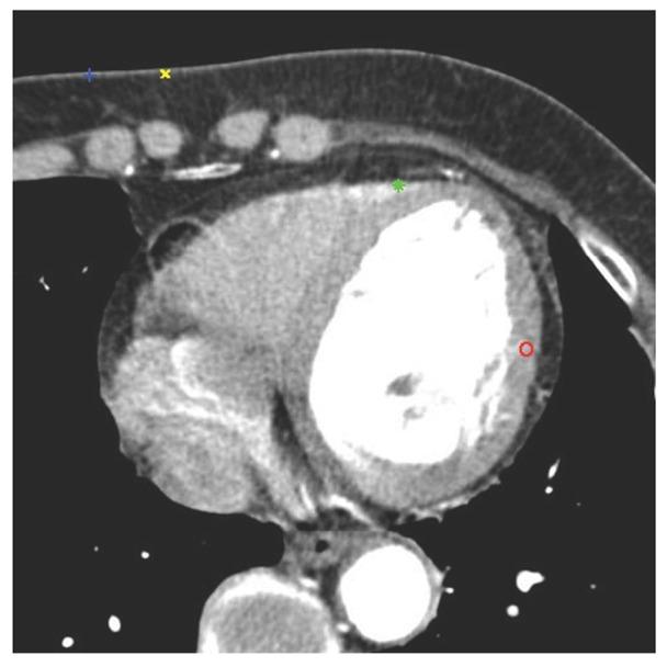 https://cdn.ncbi.nlm.nih.gov/pmc/blobs/566d/4148338/fc379d406b82/pone.0105815.g002.jpg