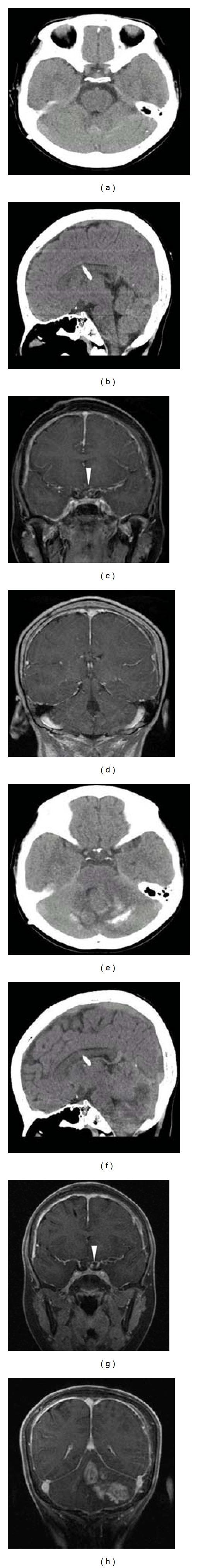 https://cdn.ncbi.nlm.nih.gov/pmc/blobs/5671/3512259/24e0187cb268/CRIM.ONCMED2012-290905.001.jpg