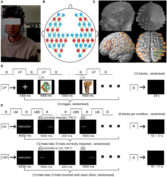 https://cdn.ncbi.nlm.nih.gov/pmc/blobs/5675/8795708/17f65d8434f9/fneur-12-784821-g0001.jpg