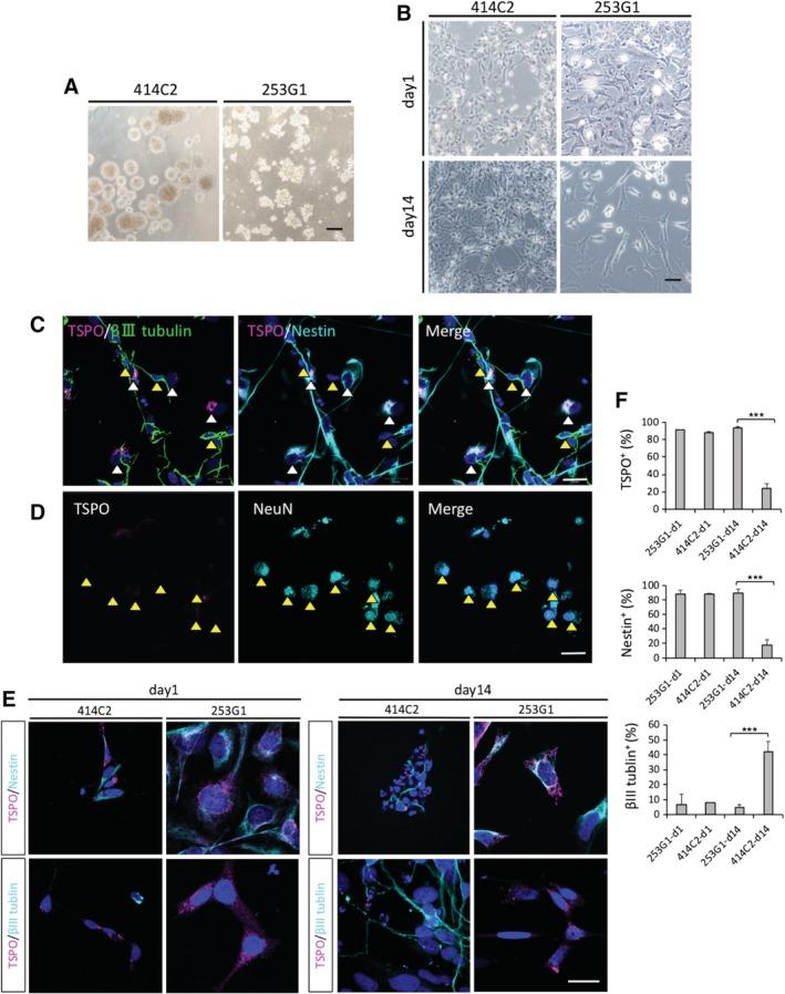 https://cdn.ncbi.nlm.nih.gov/pmc/blobs/5679/7103627/1aa05ff0cf6b/SCT3-9-465-g001.jpg