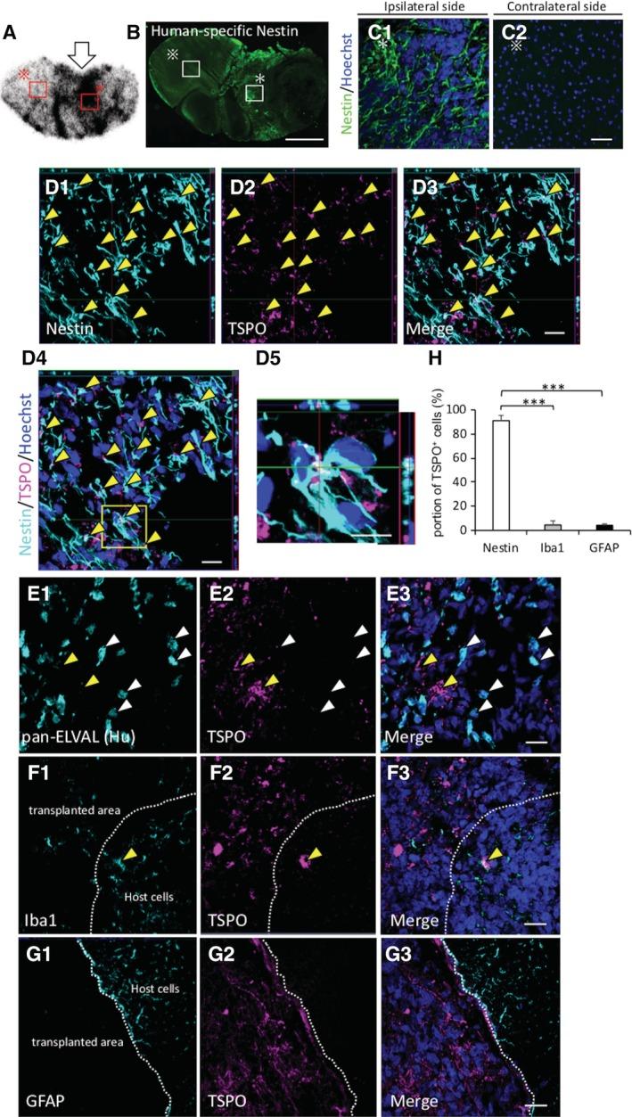 https://cdn.ncbi.nlm.nih.gov/pmc/blobs/5679/7103627/3d8377e84915/SCT3-9-465-g006.jpg