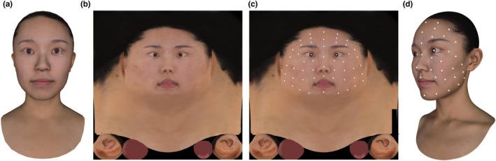 https://cdn.ncbi.nlm.nih.gov/pmc/blobs/5679/9826081/8eb099dee4bc/ICS-44-703-g009.jpg
