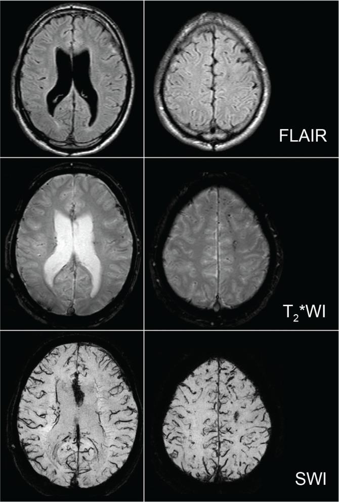 https://cdn.ncbi.nlm.nih.gov/pmc/blobs/567c/5447811/e57f64529fb6/nmc-57-199-g3.jpg