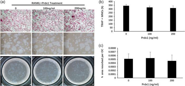 https://cdn.ncbi.nlm.nih.gov/pmc/blobs/5680/11649962/4c7853e9ec03/JCP-239-0-g003.jpg