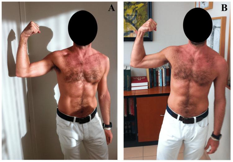 https://cdn.ncbi.nlm.nih.gov/pmc/blobs/5686/11132310/206e5bc00136/cureus-0016-00000059217-i03.jpg