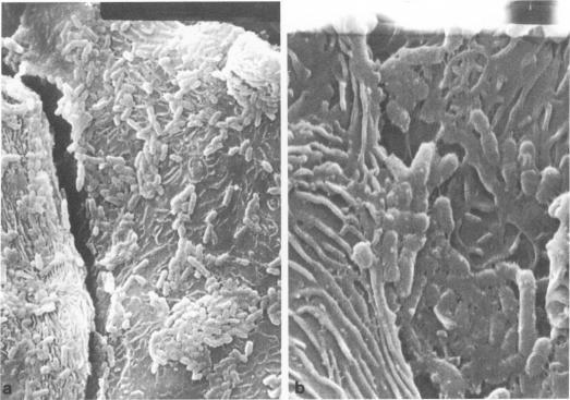 https://cdn.ncbi.nlm.nih.gov/pmc/blobs/568a/351097/04bcf8341599/iai00154-0325-a.jpg