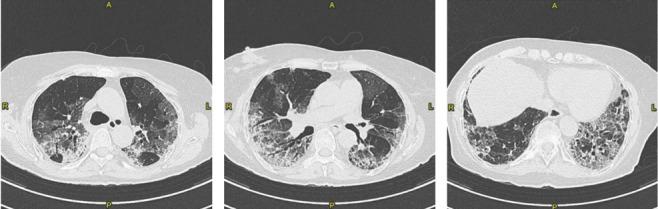 https://cdn.ncbi.nlm.nih.gov/pmc/blobs/568f/8972879/44c998ea806b/ACTA-93-15-g003.jpg