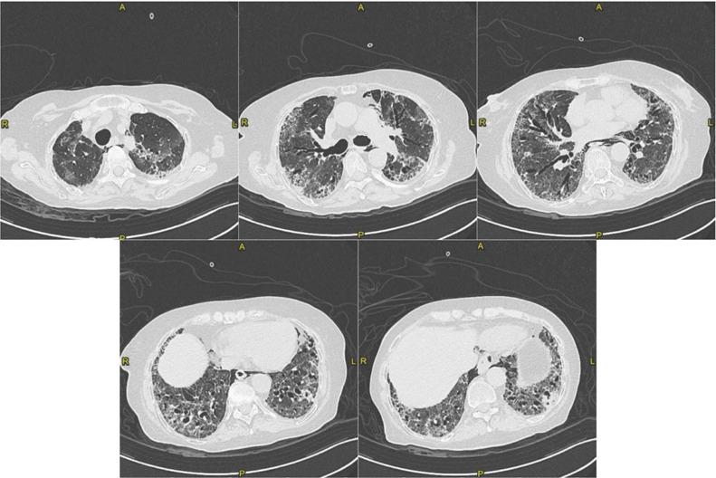 https://cdn.ncbi.nlm.nih.gov/pmc/blobs/568f/8972879/a806f600492a/ACTA-93-15-g005.jpg