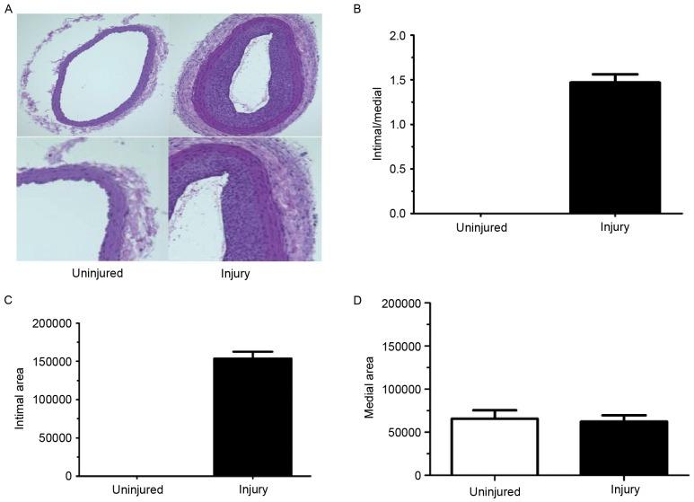https://cdn.ncbi.nlm.nih.gov/pmc/blobs/569c/5779884/80b9bc5d99a3/MMR-16-06-8003-g00.jpg