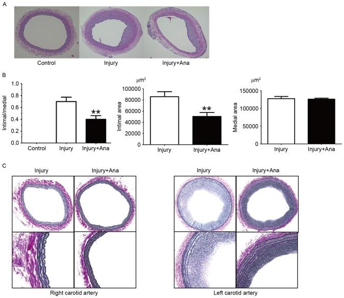 https://cdn.ncbi.nlm.nih.gov/pmc/blobs/569c/5779884/8c3042061a0a/MMR-16-06-8003-g01.jpg