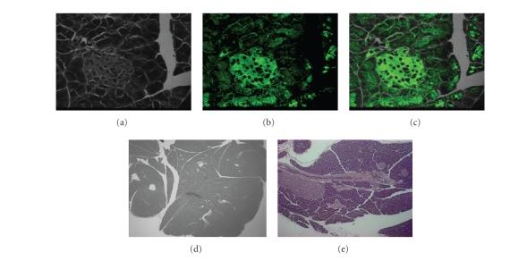 https://cdn.ncbi.nlm.nih.gov/pmc/blobs/56a6/2375978/ec80caa28973/EDR2008-371716.004.jpg