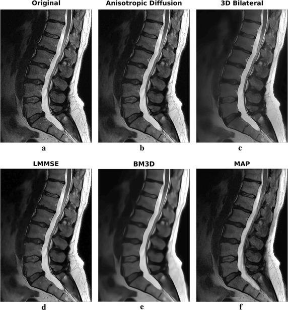 https://cdn.ncbi.nlm.nih.gov/pmc/blobs/56a6/5297150/6692157dcfa8/12938_2017_319_Fig12_HTML.jpg