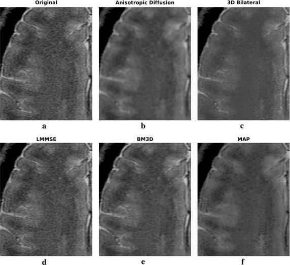 https://cdn.ncbi.nlm.nih.gov/pmc/blobs/56a6/5297150/a180f55cb504/12938_2017_319_Fig9_HTML.jpg