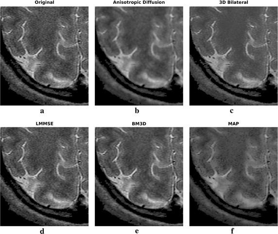https://cdn.ncbi.nlm.nih.gov/pmc/blobs/56a6/5297150/b56cf97ce8b7/12938_2017_319_Fig10_HTML.jpg