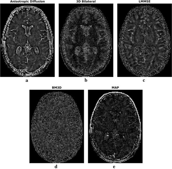 https://cdn.ncbi.nlm.nih.gov/pmc/blobs/56a6/5297150/e4f13d4ee318/12938_2017_319_Fig4_HTML.jpg