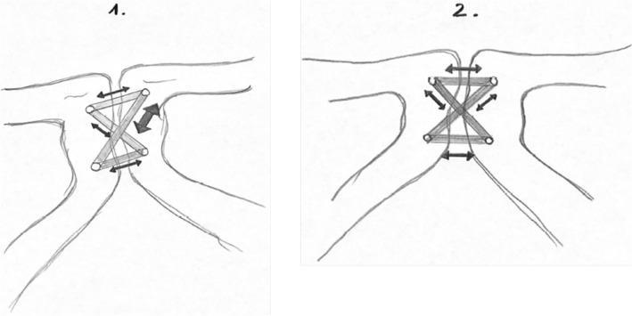 https://cdn.ncbi.nlm.nih.gov/pmc/blobs/56a9/10192136/9fb14d06e1fd/402_2022_4547_Fig4_HTML.jpg