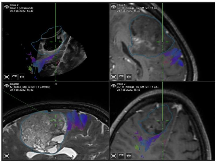 https://cdn.ncbi.nlm.nih.gov/pmc/blobs/56aa/9498154/10a83c361032/curroncol-29-00518-g009.jpg