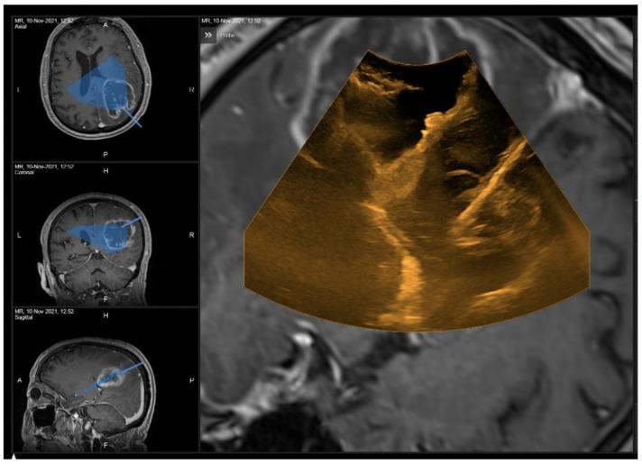 https://cdn.ncbi.nlm.nih.gov/pmc/blobs/56aa/9498154/6db3d334c53c/curroncol-29-00518-g012.jpg