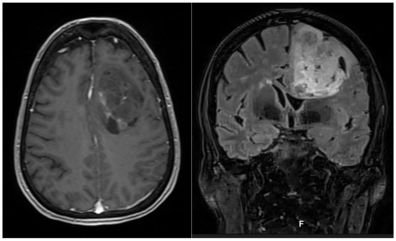 https://cdn.ncbi.nlm.nih.gov/pmc/blobs/56aa/9498154/8540ac5a66e5/curroncol-29-00518-g007.jpg