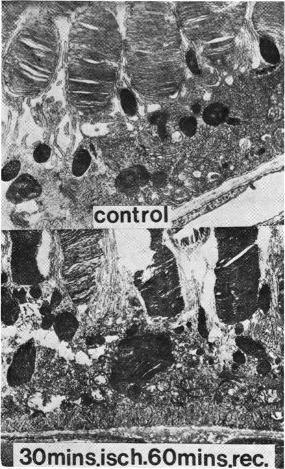 https://cdn.ncbi.nlm.nih.gov/pmc/blobs/56ac/1043402/f54a2e83c5cc/brjopthal00206-0004-a.jpg
