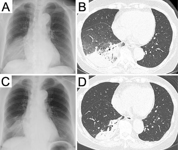 https://cdn.ncbi.nlm.nih.gov/pmc/blobs/56c2/10017238/f0f2a82f99b8/1349-7235-62-0583-g001.jpg