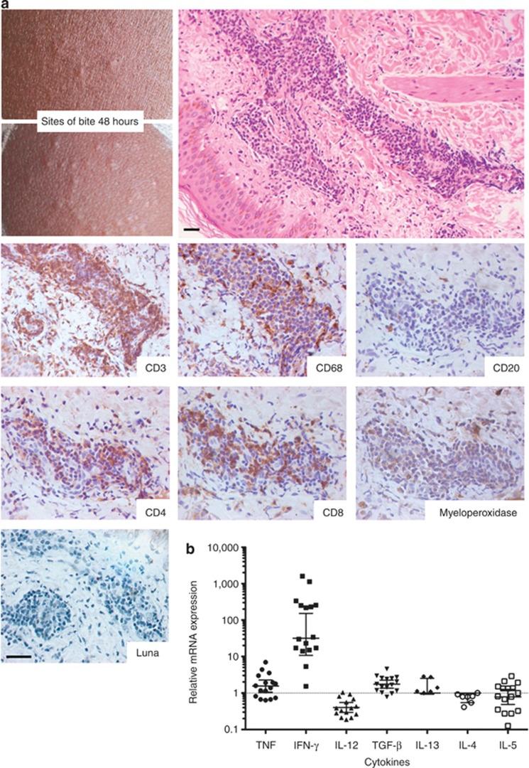 https://cdn.ncbi.nlm.nih.gov/pmc/blobs/56c2/3547224/325b0f246c7d/jid2012315f2.jpg