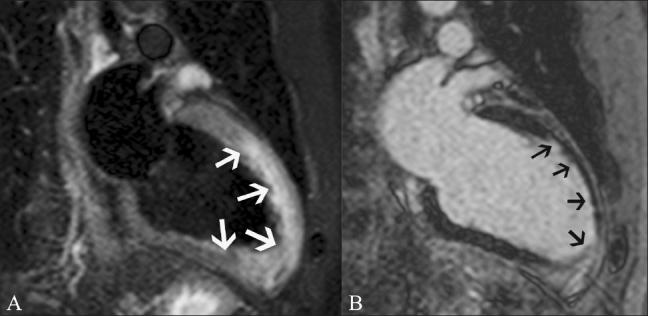 https://cdn.ncbi.nlm.nih.gov/pmc/blobs/56cb/3137850/2086ef03b9ba/IJRI-21-124-g003.jpg