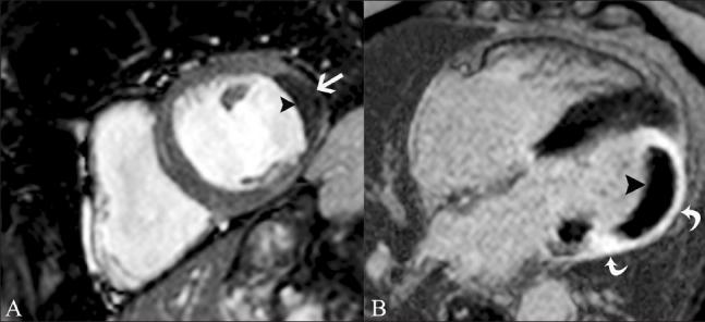 https://cdn.ncbi.nlm.nih.gov/pmc/blobs/56cb/3137850/5b916abdc452/IJRI-21-124-g010.jpg