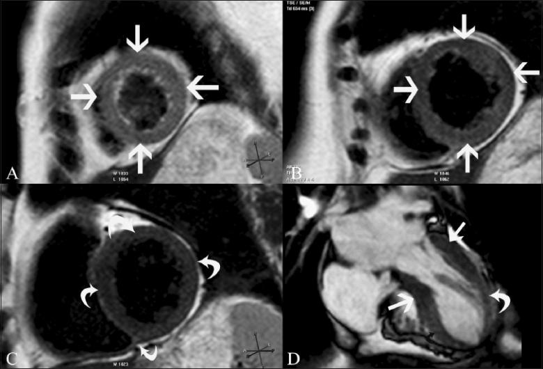 https://cdn.ncbi.nlm.nih.gov/pmc/blobs/56cb/3137850/7799170bc341/IJRI-21-124-g008.jpg