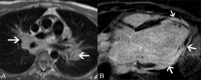 https://cdn.ncbi.nlm.nih.gov/pmc/blobs/56cb/3137850/87be22d49766/IJRI-21-124-g011.jpg