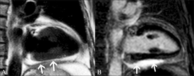 https://cdn.ncbi.nlm.nih.gov/pmc/blobs/56cb/3137850/973970205ee8/IJRI-21-124-g007.jpg