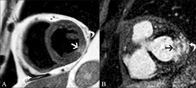 https://cdn.ncbi.nlm.nih.gov/pmc/blobs/56cb/3137850/d851ae354297/IJRI-21-124-g006.jpg