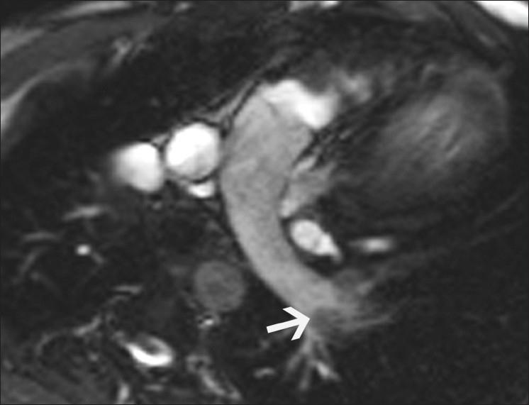 https://cdn.ncbi.nlm.nih.gov/pmc/blobs/56cb/3137850/e33d9abf7729/IJRI-21-124-g013.jpg
