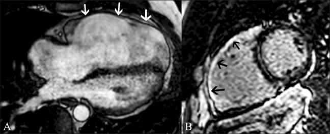 https://cdn.ncbi.nlm.nih.gov/pmc/blobs/56cb/3137850/f140fd83ac02/IJRI-21-124-g014.jpg