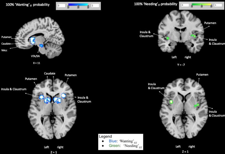 https://cdn.ncbi.nlm.nih.gov/pmc/blobs/56cb/9480935/2e8d1739fbf1/BRB3-12-e32713-g003.jpg