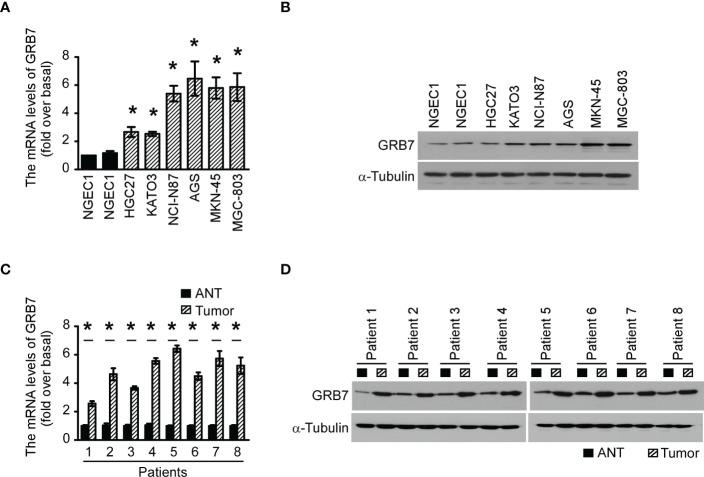 https://cdn.ncbi.nlm.nih.gov/pmc/blobs/56d1/9846623/70cc5160ec60/fonc-12-1054976-g001.jpg