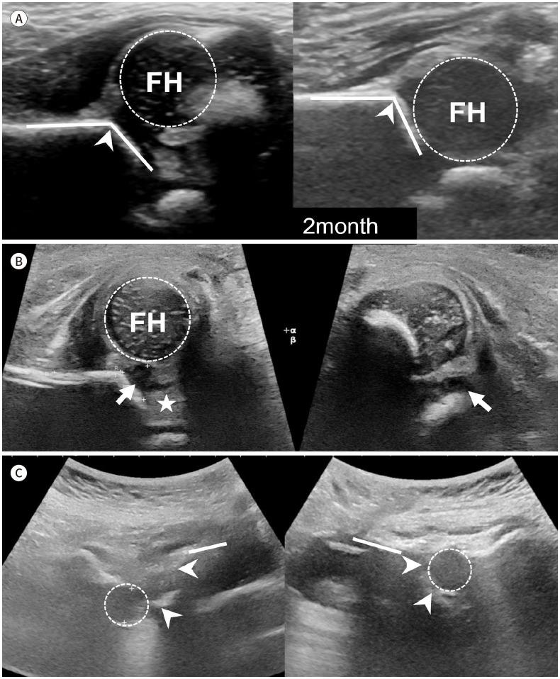 https://cdn.ncbi.nlm.nih.gov/pmc/blobs/56d4/11166597/422ff4d87338/jksr-85-531-g004.jpg