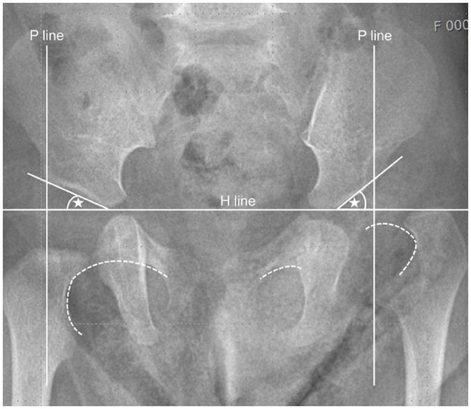 https://cdn.ncbi.nlm.nih.gov/pmc/blobs/56d4/11166597/ac25c1a7eee8/jksr-85-531-g001.jpg