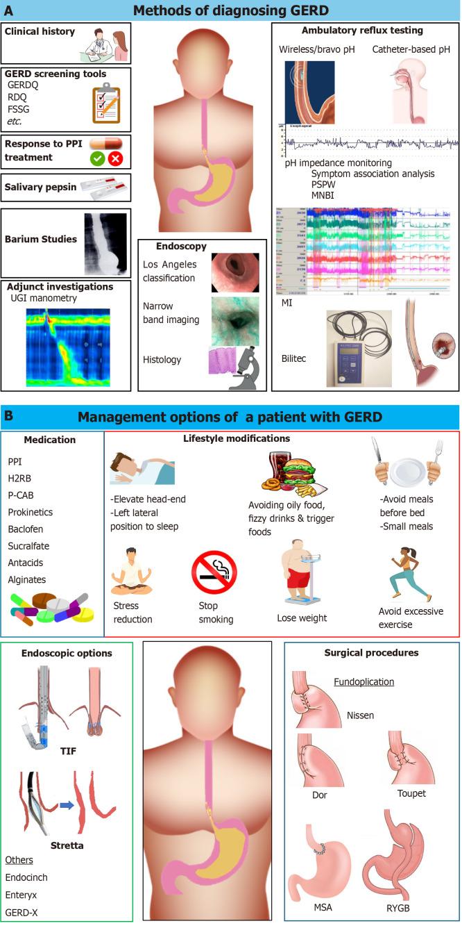 https://cdn.ncbi.nlm.nih.gov/pmc/blobs/56db/11684178/26e3e626a7c5/98479-g004.jpg