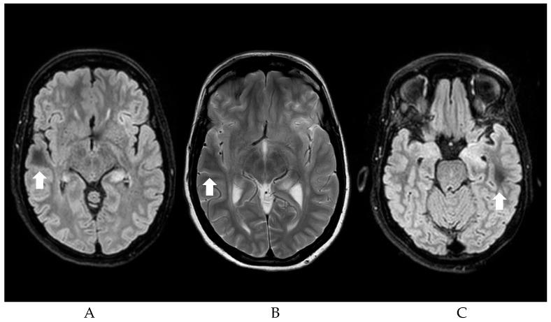 https://cdn.ncbi.nlm.nih.gov/pmc/blobs/56df/12249862/2c60627a933a/jcm-14-04607-g001.jpg